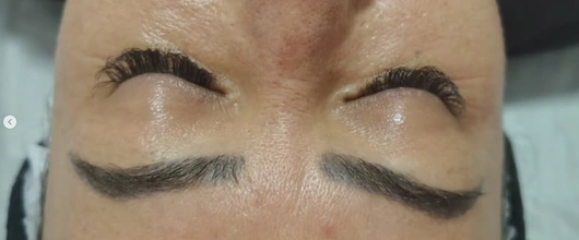 Limpeza de pele e Protocolo Coreano